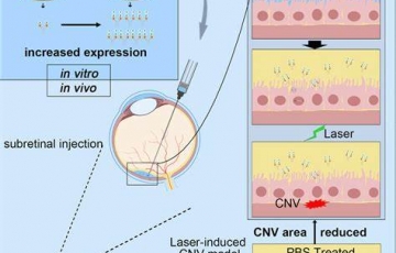 Gene Therapy for Age-Related Macular Degeneration: A New Era in Vision Care
